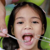 Pediatric Dentistry - Pediatric Dentistry treatment turkey